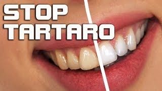 Togliere il tartaro dai denti rimedi naturali per la pulizia dei denti [upl. by Merill243]