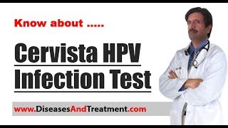 HPV Test Cervista Human Papillomavirus Infection Test in Women [upl. by Holna]