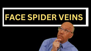 How to Treat Spider Veins on the Face 5 Essential Facts for Doctors and Nurses [upl. by Isyed258]