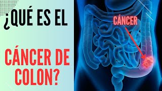 ¿Qué es el cáncer de colon [upl. by Eisyak]