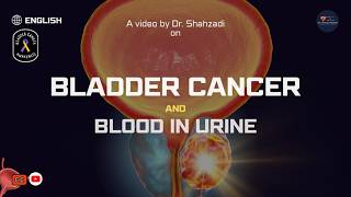 Bladder Cancer Early Signs Symptoms and Blood in Urine Explained [upl. by Fenwick]