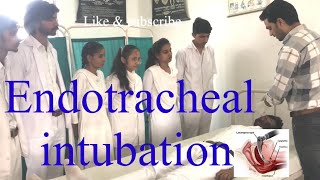 Endotracheal Tube  Intubation Procedure Ventilatior How to Insert Endotracheal TubeET Tube HINDI [upl. by Abbie104]