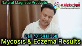 Ebiotorium Magnetic Mattress Results In Mycosis amp Eczema More Info Order amp Joining 917015411368 [upl. by Echikson]