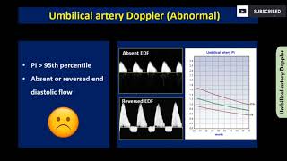 Obstetric doppler made easy [upl. by Skricki857]