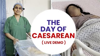 The day of caesarean Live Demo Dr Asha Gavade [upl. by Abroms]