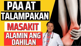 Paa at Talampakan Masakit Alamin ang Dahilan  By Doc Willie Ong Internist and Cardiologist [upl. by Foscalina]