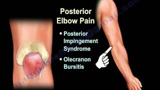 ELBOW PAIN  COMMON CAUSES  Everything You Need To Know  Dr Nabil Ebraheim [upl. by Nyrraf]