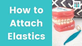 HOW TO PUT ELASTICS ON CLEAR ALIGNERS l Dr Melissa Bailey [upl. by Arline]