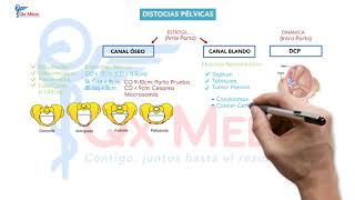 Ficha resumen Obstetricia Distocias pélvicas ENAMENARMSERUMS [upl. by Roy]