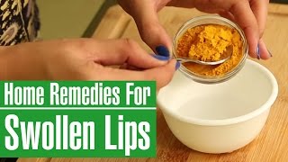 How To Get Rid Of A SWOLLEN LIPS Fast With Home Remedies [upl. by Ondine]