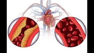 Olmesartan medoxomil review  olmesartan medoxomil side effects  Olmesartan medoxomil for high BP [upl. by Gautious]