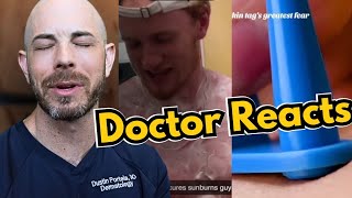 Doctor Reacts to Wart Freezing Cyst Popping Sunburn [upl. by Vincelette]