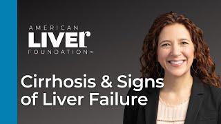 Progression of Liver Disease Webcast Series Cirrhosis and Signs of Liver Failure [upl. by Sidney]