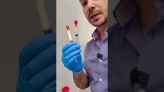 Biofiller How to convert PRP into most natural filler for rejuvenating and revolumize the face [upl. by Pickford94]