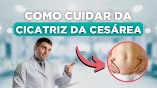 Como Cuidar da Cicatriz da Cesariana [upl. by Delfine]