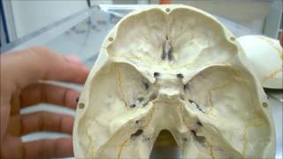 Aula Neuroanatomia  Nervos Cranianos Pares Cranianos  Visão Geral  Neuroanatomia Humana 6 [upl. by Eilagam]