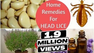 Top 5 Home Remedies To Get Rid Of Head LICE amp Nits  Sushmitas Diaries [upl. by Zeke]