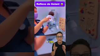 Reflexo de Galant😱👶 medicina medico pediatria enfermagem enfermeira pediatriaonline pediatra [upl. by Egbert]