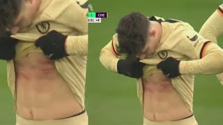 Kai Havertz body after being studded by Amartey chelsea vs leicester [upl. by Aerdnahs]