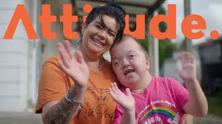 Maddies Life with Pfeiffer Syndrome [upl. by Aidul]