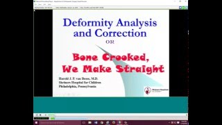 Deformity Analysis and Correction [upl. by Elocen385]