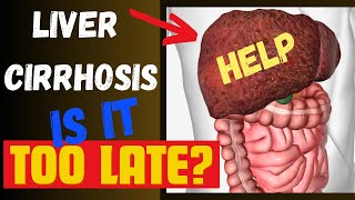 Can LIVER CIRRHOSIS be Reversed  EndStage Liver Disease  Clinical Bliss [upl. by Augie379]