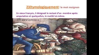 traumatologie AMPUTATIONS DE MEMBRE INFERIEUR [upl. by Adnerb937]