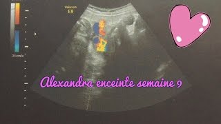 Alexandra enceinte  semaine 9 [upl. by Ahcatan551]