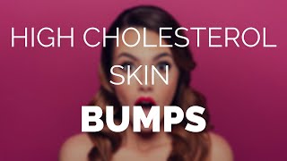 High cholesterol skin bumps and how to easily remove them [upl. by Noreen]