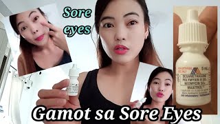 GAMOT SA SORE EYES RECOMMEND BY THE DOCTOR [upl. by Adel]