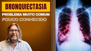 Bronquiectasias problema pulmonar desconhecido mas muito comum [upl. by Achorn]