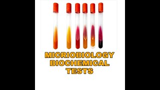 Biochemical Tests for Bacterial IdentificationTSIUrease Citratemicrobiology Biochemical tests [upl. by Llerrahs]