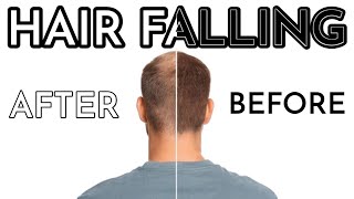 The BEST Solution of Hair Fall and its Regrowth  Homeopathic Treatment  By Dr Ataullah [upl. by Yle]