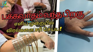 paralysis exercise for hand and leg  stroke patients finger exercise machine  stroke rehab physio [upl. by Natye66]