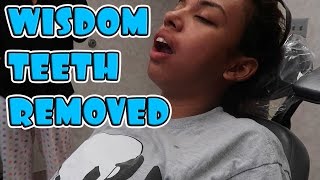 FUNNY WISDOM TEETH REMOVAL [upl. by Laetitia]