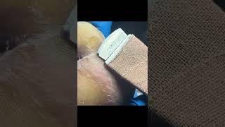 Charming Pedicure Video  Remove Dead Skin [upl. by Euqininod]