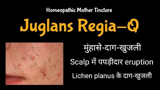 Juglans RegiaQ  Homeopathic Mother Tincture  DrMahavir Vyas [upl. by Holmes]