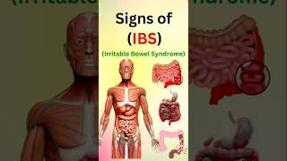 WARNING IBS Symptoms That Can RUIN Your Life [upl. by Akeenat]