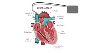 Pacemaker Issues Explained Part 2 Decoding Undersensing [upl. by Naelopan664]