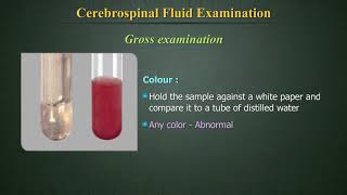 Cerebrospinal Fluid Examination CSF [upl. by Silrac]