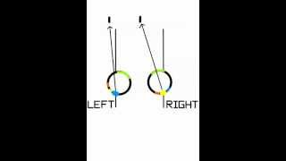 diplopia uncrossed vs crossed [upl. by Gross260]