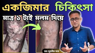 একজিমা  চুলকানি  LSC  Treatment  Only 1 cream  Dr Supratim Saha [upl. by Yenterb61]