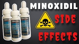 Minoxidil Side Effects  What To Expect [upl. by Aleahc]