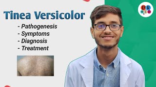 Superficial mycoses  Tinea Versicolor  Malassezia furfur  Microbiology bangla lecture [upl. by Arimahs]