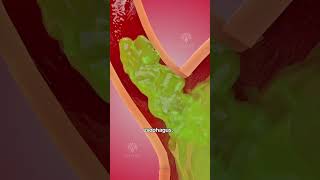 How acid reflux happens 🥵 Acidity and gas problem  GERD shorts viralvideo  creativelearning3d [upl. by Chung740]