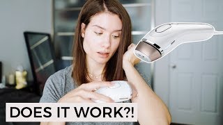 Braun Silk Expert IPL Laser Hair Removal at Home Demonstration  Review [upl. by Lednic134]