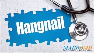 Hangnail ¦ Treatment and Symptoms [upl. by Meehyr]