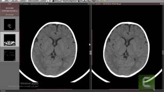 RadiAnt Dicom viewer Basics tips in arabic [upl. by Brott886]