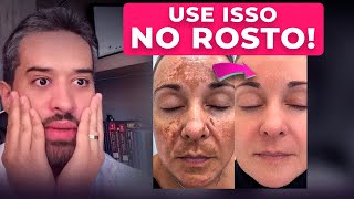 MÁGICA NA PELE Receita POTENTE MELHOR QUE BOTOX Remove MANCHAS DA PELE muito RÁPIDO [upl. by Letsyrhc]