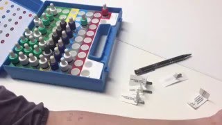 Allergietest  Prick Test [upl. by Sivram125]